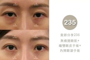 235