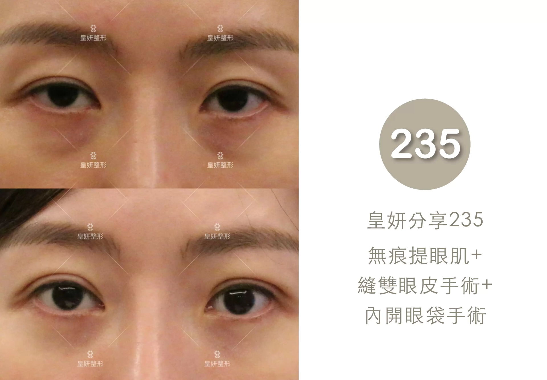 235