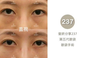 237
