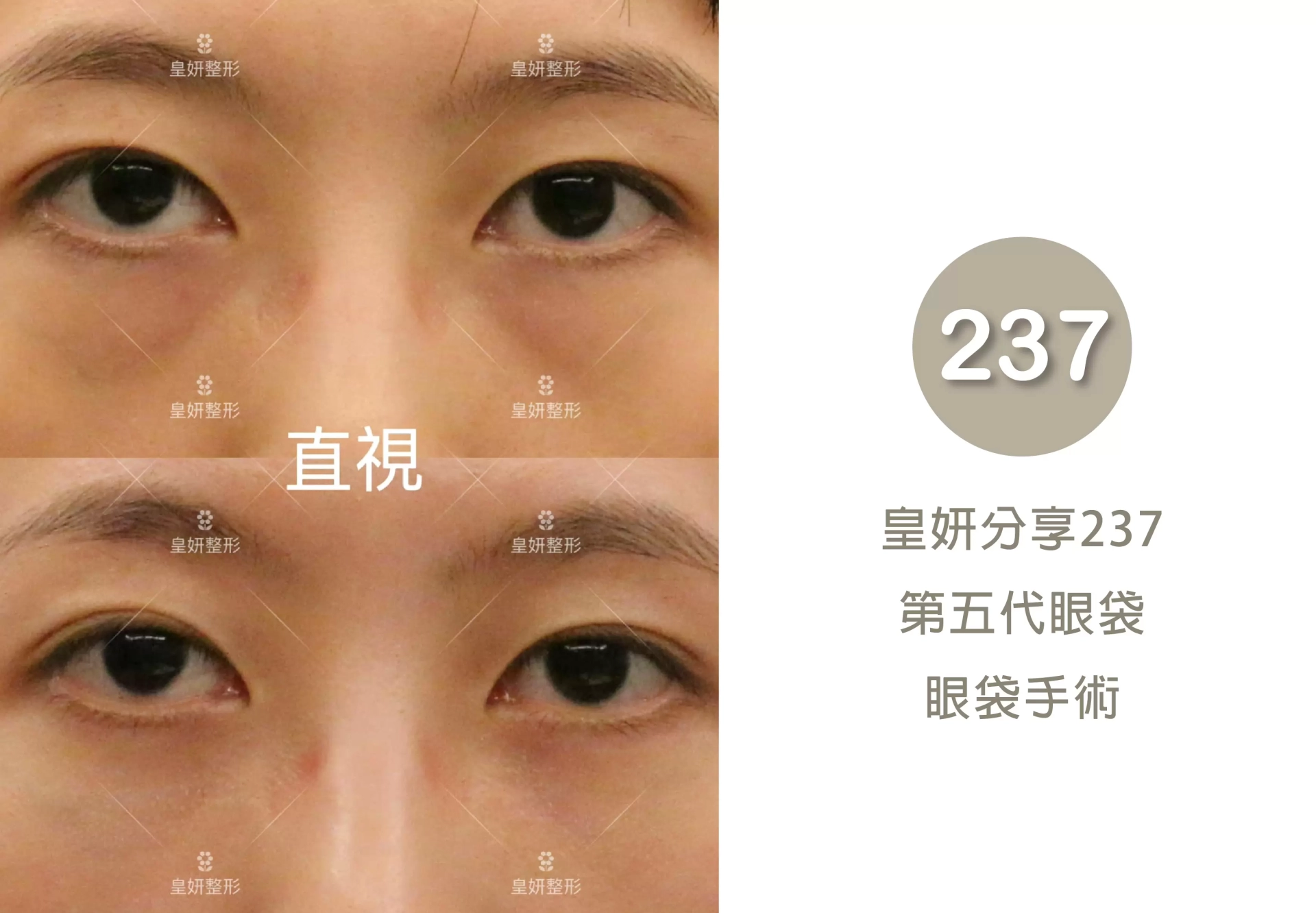 237
