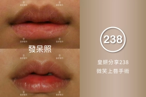 238