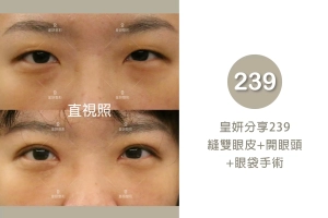 239
