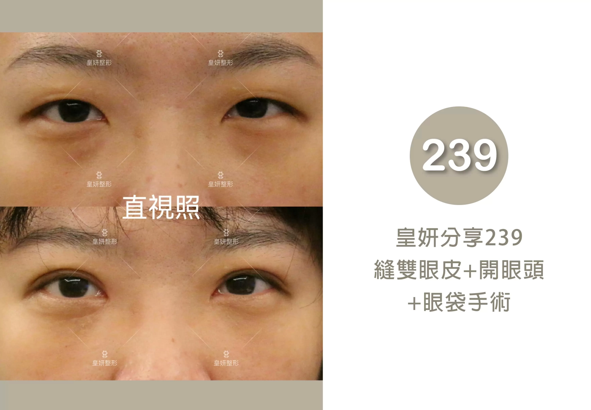 239